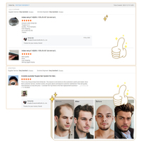Emeda - Sistema de Reemplazo Capilar Económico y Duradero con Cabello Humano Remy Indio de Primera Calidad, Prótesis Capilar