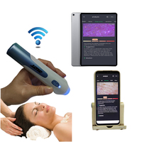 Microscope numérique WiFi pour dermatologues, détecteur sans fil, analyseur de peau compatible avec iPhone, iPad, Android