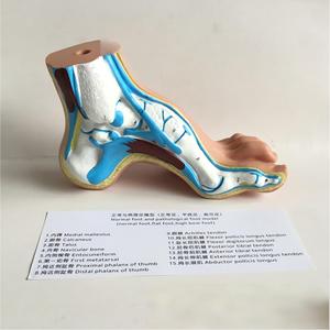 Podiatri Öğretimi için 3 Çeşit Ayak Kemeri Anatomisi Modeli Normal Düz ve Yüksek Kemerli Ayaklar - Product Image 2