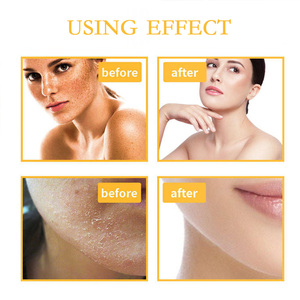 <span class=keywords><strong>Exfoliante</strong></span> Corporal <span class=keywords><strong>de</strong></span> Cúrcuma y Vitamina C para la Piel, Exfoliantes Corporales <span class=keywords><strong>Tree</strong></span> <span class=keywords><strong>Hut</strong></span> para Venta al por Menor - Product Image 3