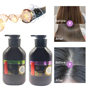 ハーブフケ防止シャンプーOEMオーガニックヘアケアバルクスカルプケアソリューション - Product Image 5