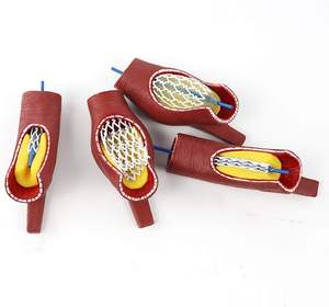 Учебные материалы по медицинским наукам: Стенты для лечения сердечно-сосудистых и цереброваскулярных заболеваний, атеросклероза - Product Image 3