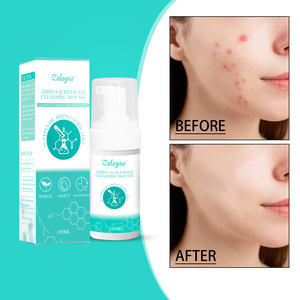 Mousse detergente viso agli aminoacidi Zaleyae, controllo del sebo, pulizia profonda, rimozione degli acari, idratante, detergente schiumogeno per il viso. - Product Image 2