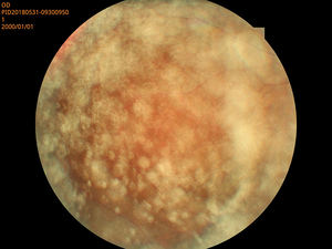 كاميرا قاع العين حار بيع RetiCam 3100 معدات طب العيون الصانع غير mydriatic العين الرقمية كاميرا قاع العين ophthalmoloy - Product Image 4