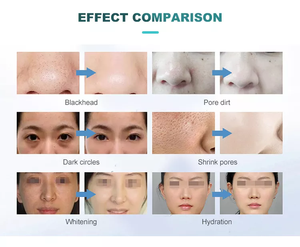 Appareil de rajeunissement de la peau au diamant de bureau 9 en 1, jet d'oxygène, microdermabrasion, aspiration, nettoyage facial en profondeur pour les lèvres, prise américaine - Product Image 6