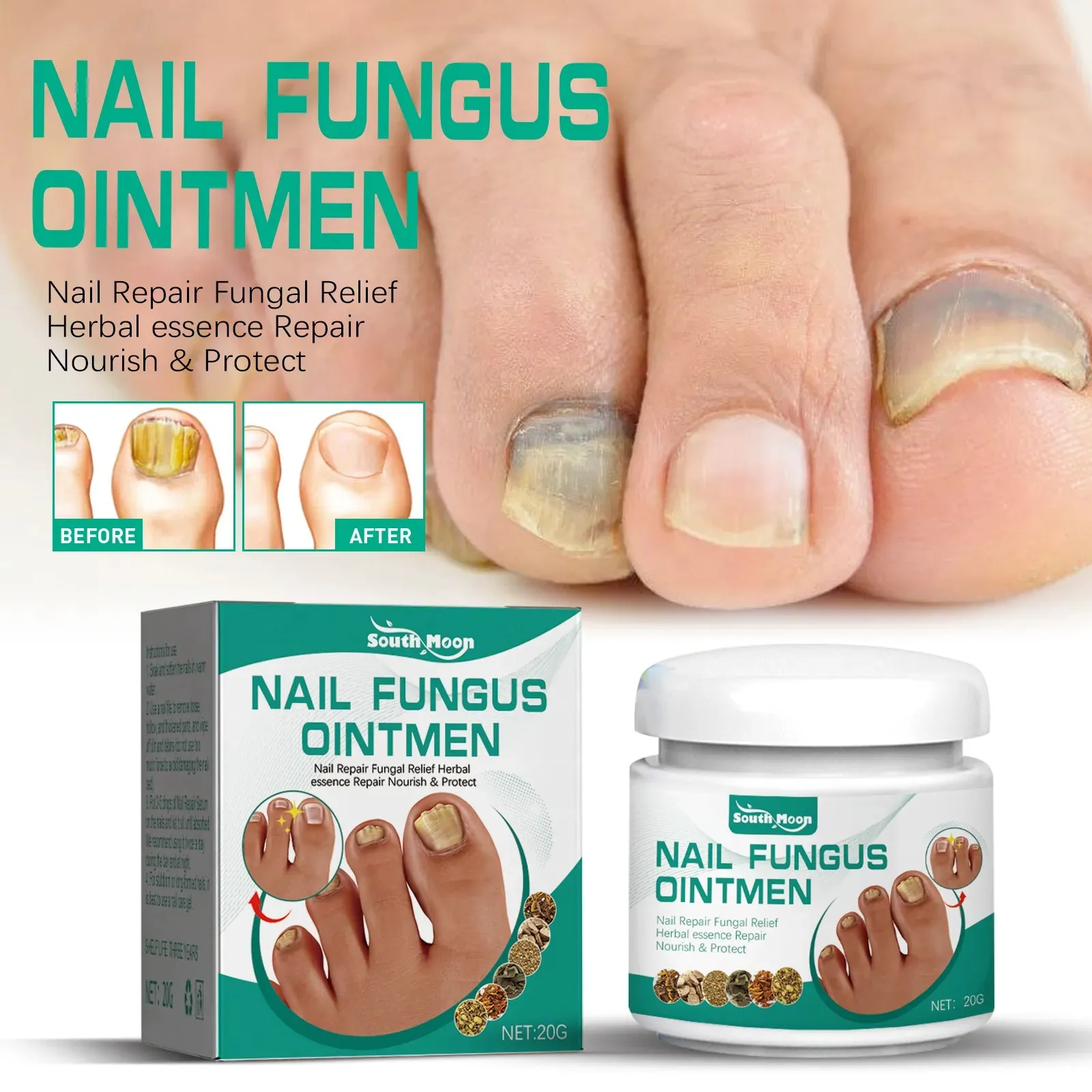 Tratamientos para hongos en las uñas Crema de suero Antihongos Pie Toe Gel de reparación de uñas Anti-infección Onicomicosis Ungüento para el cuidado de la paroniquia