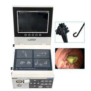 Mindray Vetina ES3 Sistema de Endoscopio Flexible Veterinario Ortopédico Portátil, Video Broncoscopio Médico para Examen de Bronquios - Product Image 4