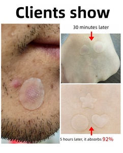 แผ่นปิดสิวไฮโดรคอลลอยด์แบบใส แผ่นปิดรอย<span class=keywords><strong>สิว</strong></span> สติ๊กเกอร์ปิดสิวแบบไมโครนีดเดิล สำหรับใบหน้าและผิว - Product Image 5