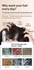 Analyseur de perte de cheveux Traitement du cuir chevelu Machine de repousse des cheveux Machine de croissance des cheveux - Product Image 4