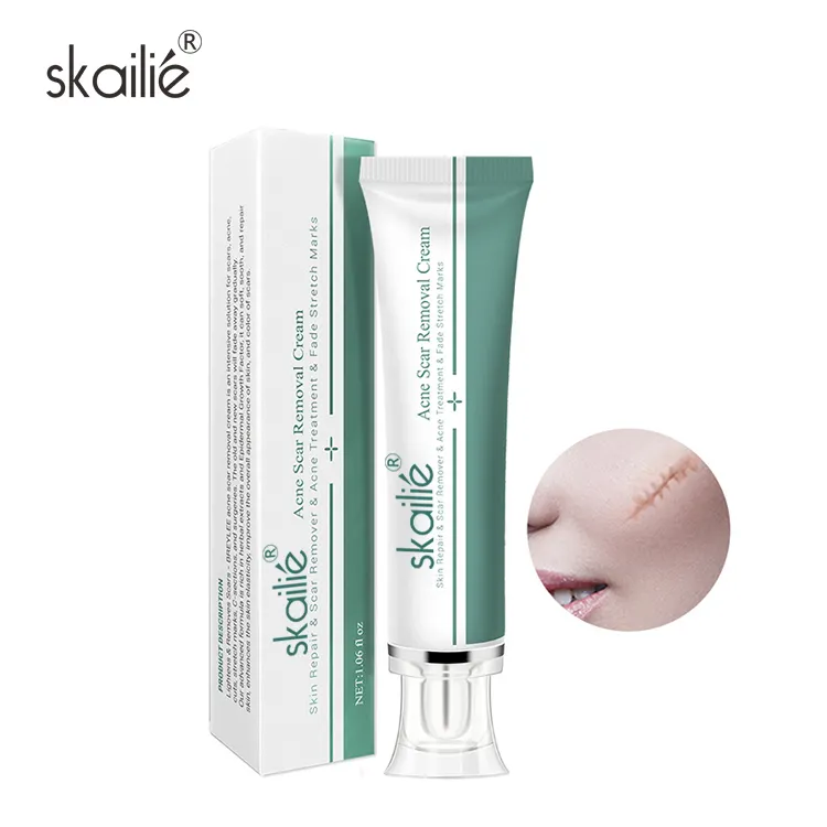 OEM private label pearl whitening remove brufoli acne anti aging face cream che è sicuro per l'acne del viso
