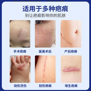 Gel de silicona medicinal para cicatrices Yajiao Pharma 20g para niños con diseño de koala de dibujos animados - Product Image 3