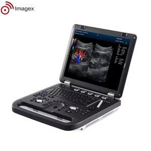 Peralatan sonografi medis sistem Ultrasound kompak dengan probe Array Linear, cembung, dan sewa - Product Image 3