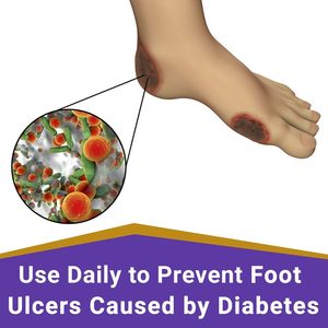 เครื่องกำจัดกลิ่นเท้าสำหรับนักกีฬาทำความสะอาดผิวเท้าทุกวัน ODM สเปรย์ล้างออกเพื่อช่วยหลีกเลี่ยงการติด<span class=keywords><strong>เชื้อ</strong></span> - Product Image 6