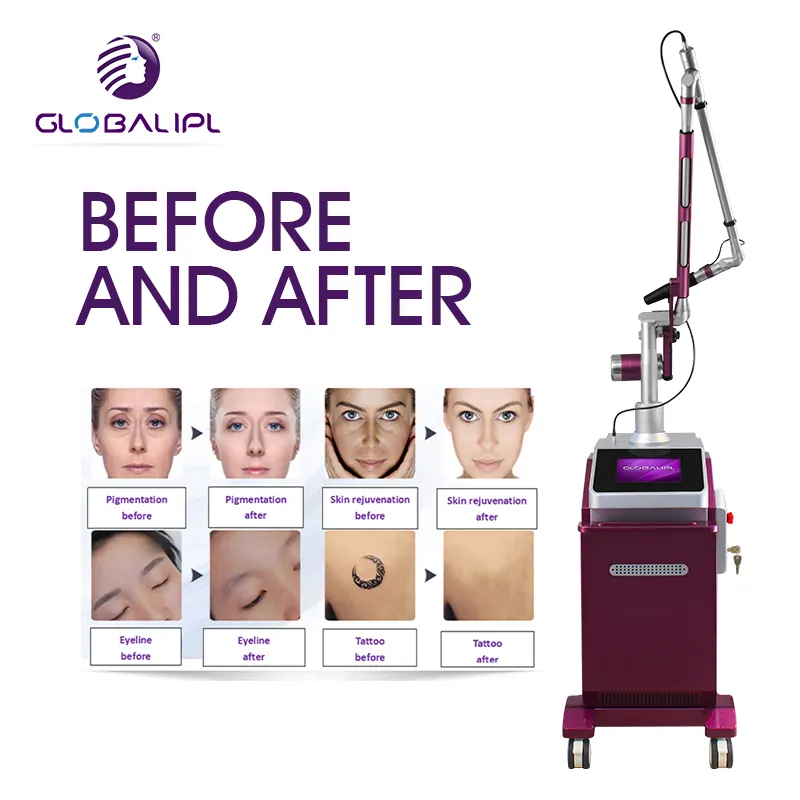 Whitening Face Eyebrow Washing Picosecond Laser Tattoo Removal Carbon Peel Pico Laser Machine