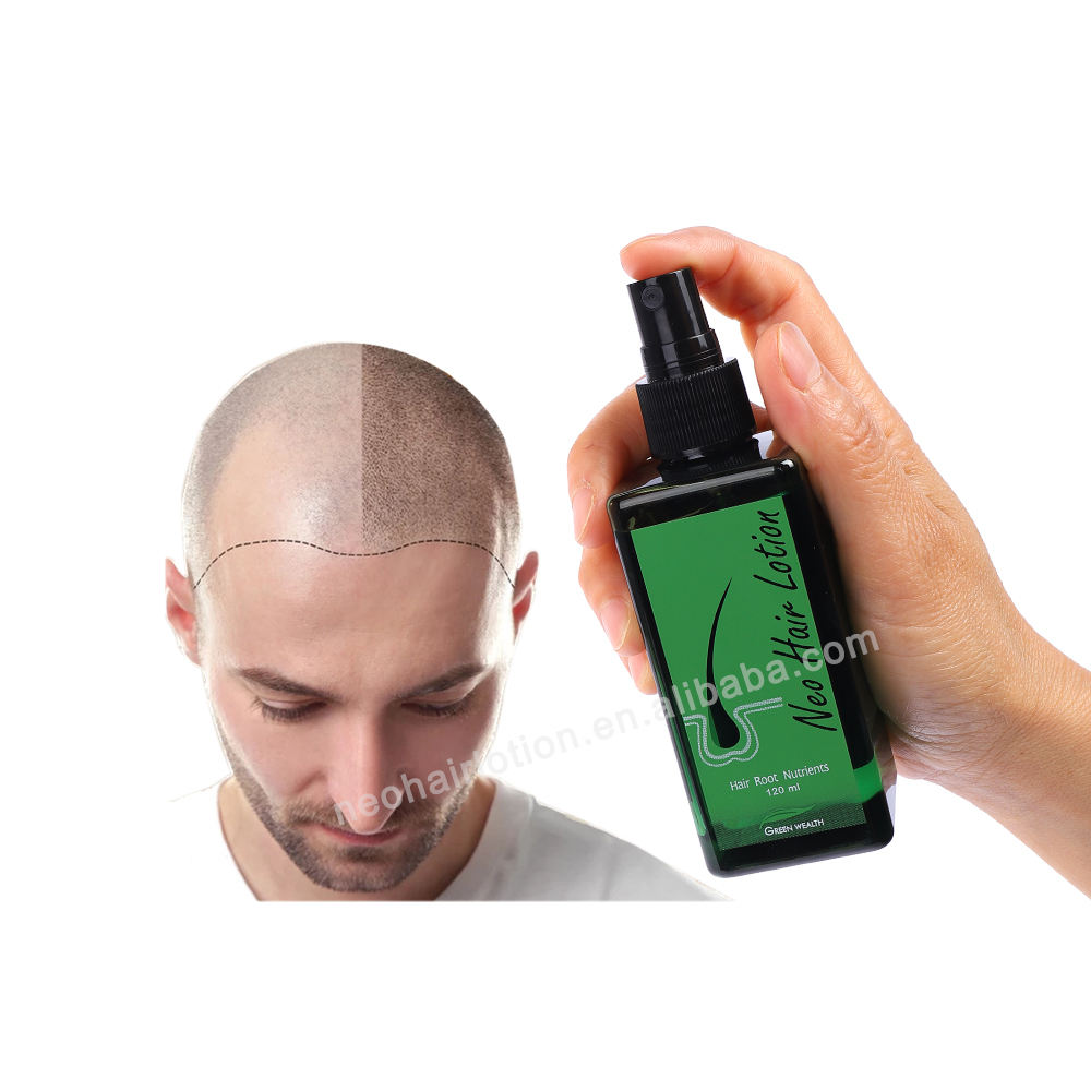 De Pelo Cortes Masculinos Para Calvos Ficando Careca Cortes De