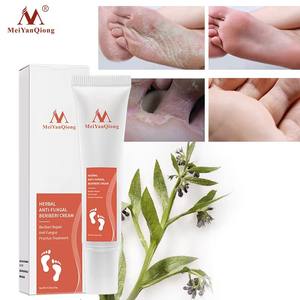 Crème pour les <span class=keywords><strong>pieds</strong></span> à base de plantes MeiYanQiong, <span class=keywords><strong>anti</strong></span>-infections fongiques, gel pour les ongles atteints de paronychie, crème réparatrice pour les <span class=keywords><strong>pieds</strong></span> secs et fissurés, crème réparatrice pour le beriberi - Product Image 3