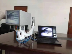 Thú Y huỳnh quang máy cho pet phòng khám di động x Ray Hệ thống HD hình ảnh bền hoạt động dễ dàng - Product Image 4