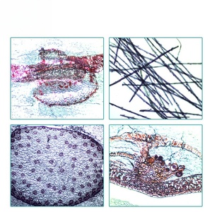 Portaobjetos de microscopio preparados con huevos de lombriz, muestras biológicas médicas para <span class=keywords><strong>la</strong></span> enseñanza de ciencias para niños y educación en el hogar - Product Image 5