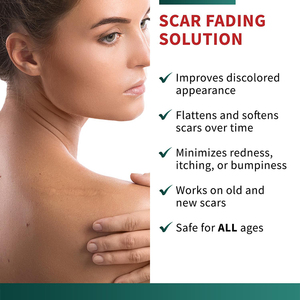 Cinta <span class=keywords><strong>de</strong></span> Gel <span class=keywords><strong>de</strong></span> Silicona <span class=keywords><strong>de</strong></span> Grado Médico YOJO para el Cuidado <span class=keywords><strong>de</strong></span> Cicatrices, Reutilizable, Hipoalergénica, Sin Látex, Desinfectada <span class=keywords><strong>con</strong></span> EO, Cinta Adhesiva - Product Image 4