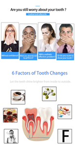 شرائط تبييض خاصة صيفية رطبة وجافة بشرائط تفتيح جل يعمل بالضوء فوق البنفسجية شرائط تبييض للمدخنين القطران والنيكوتين لإزالة البقع - Product Image 6