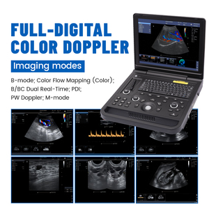 Ecógrafo Doppler Color Mini de Bajo <span class=keywords><strong>Precio</strong></span>, Dispositivo de Ultrasonido Médico - Product Image 5