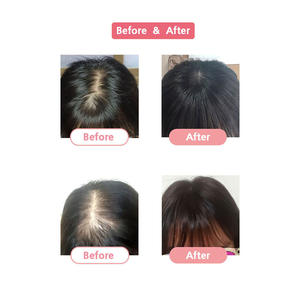 Cosmo in Korea - Pelucas Coreanas Premium (8x9) de Cabello Humano Natural Liso Remy de 8 Pulgadas, Peluca Completa de Encaje para Mujer - Product Image 5