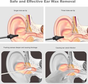 Kit de nettoyage de cérumen pour adultes Offre Spéciale alimenté à l'<span class=keywords><strong>eau</strong></span> à usage domestique équipement de rinçage des oreilles matière plastique type de prise américaine - Product Image 5