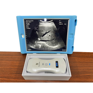 Ecógrafo Portátil Inalámbrico 3 en 1 con Doppler Color e IA, Garantía de Dos Años, <span class=keywords><strong>Precio</strong></span> de Máquina de Ultrasonido - Product Image 4