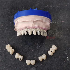 Implan gigi kustom Titanium <span class=keywords><strong>Abutment</strong></span> dengan Screwed Zirconia mahkota untuk latihan gigi En China <span class=keywords><strong>Dental</strong></span> Lab - Product Image 4