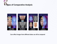 Analyseur d'images de peau facial IA avancé avec synchronisation des données sur le cloud et prédiction du vieillissement pour usage domestique