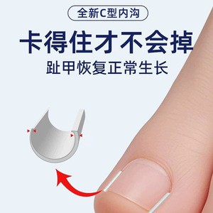 Xinzhangmen Toenail Care Isolation <b>Pads</b> 10pcs/box Nail Groove Corrector Ingrown Toenail Patch Assistive Toenail - Product Image 3