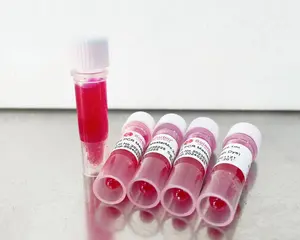 Solarbio高品質1ml 5ml 100ml PCRマスターミックス、赤色染料付き