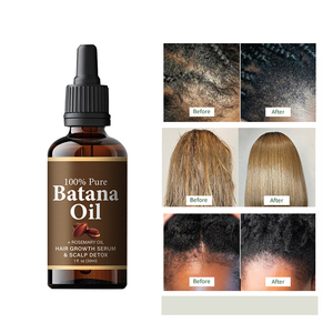 <span class=keywords><strong>Huile</strong></span> de Batana 100% Pure, Naturelle et Biologique pour Renforcer les Racines <span class=keywords><strong>des</strong></span> <span class=keywords><strong>Cheveux</strong></span>, Stimuler <span class=keywords><strong>la</strong></span> Croissance et l'Épaisseur - Product Image 1
