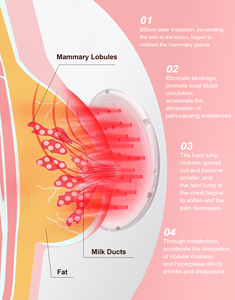 Sujetador Eléctrico para el Cáncer <span class=keywords><strong>de</strong></span> Mama para Uso Doméstico, Terapia Láser, Equipo <span class=keywords><strong>de</strong></span> Rehabilitación <span class=keywords><strong>de</strong></span> <span class=keywords><strong>Mastitis</strong></span>, Función <span class=keywords><strong>de</strong></span> Masaje <span class=keywords><strong>de</strong></span> Senos, Certificado RoHS - Product Image 4