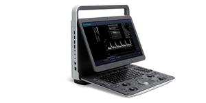 Échographe vétérinaire portable Sonoscape E1 avec Doppler couleur, machine à ultrasons médicale pour ordinateur portable, diagnostic animal 3D 4D, prix compétitif pour les vétérinaires - Product Image 3