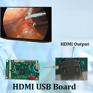 Decodificador de Imagen de Placa HDMI Endoscópica con Función HDMI para Veterinaria - Product Image 1