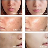 Sérum Double Glutathion et Acide Kojique pour Traitement Éclaircissant Anti-taches à la Vitamine C Soin Visage Professionnel OEM/ODM