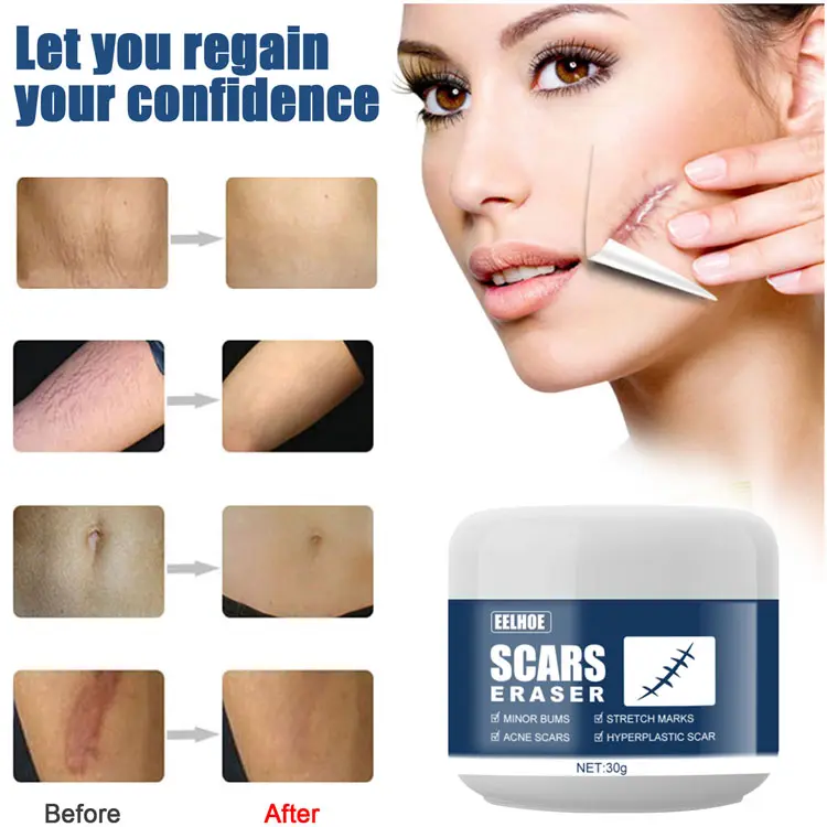 Crema antiarrugas para el cuidado de la piel, tratamiento avanzado para eliminar cicatrices en el cuerpo y la piel