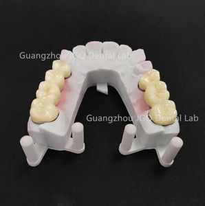 Prothèses dentaires en <span class=keywords><strong>zircone</strong></span> toutes les couronnes et ponts en céramique de haute qualité, bonne biocompatibilité et prix abordable - Product Image 6