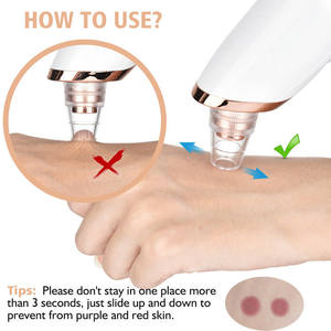 Hot Sale Electric <strong>Blackhead</strong> <strong>Remover</strong> Low Price Pore Deep Cleaning <strong>Tool</strong> with Vacuum Suction Technology - Product Image 4