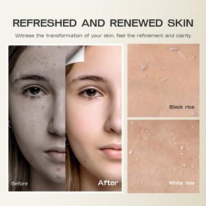 Chăm sóc da mặt Peel Shot Exfoliant gạo đen Ampoule huyết thanh Niacinamide làm sáng lỗ chân lông thu hẹp vỏ bắn Glow gạo Ampoule - Product Image 5