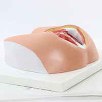 Anatomie périnéale et du plancher pelvien chez la femme, incision latérale périnéale, obstétrique, CE/ISO, pour les sciences médicales avancées