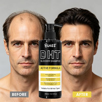 Ensemble Shampoing et Après-Shampoing Bloqueur de DHT Marque Blanche à la Palmier Nain – Soin Nourrissant du Cuir Chevelu, Fortifiant, Anti-Casse pour Cheveux Fins