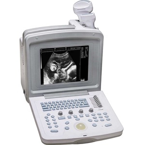 YSB180V Ysenmed portátil veterinario animal ultrasonido escáner mascotas salud ultrasonido veterinario ultrasonido quirúrgico - Product Image 3