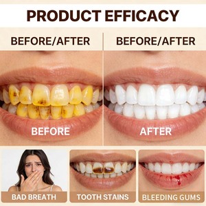 Tabletas de Pasta Dental Personalizadas OEM/ODM con 5% de Nano-Hidroxiapatita y Niacinamida, Tabletas Masticables para Enjuague Bucal - Product Image 5