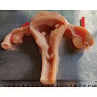 Módulo Biomimético 3D KyrenMed para Práctica de Sutura y Desprendimiento Laparoscópico Ginecológico, Modelo de Silicona Uterina Simulada