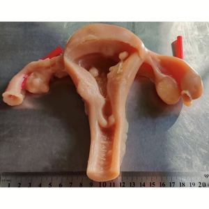 Modulo biomimetico KyrenMed 3D per taglio ginecologico laparoscopico sutura Stripping pratica simulato in Silicone uterino modello - Product Image 2
