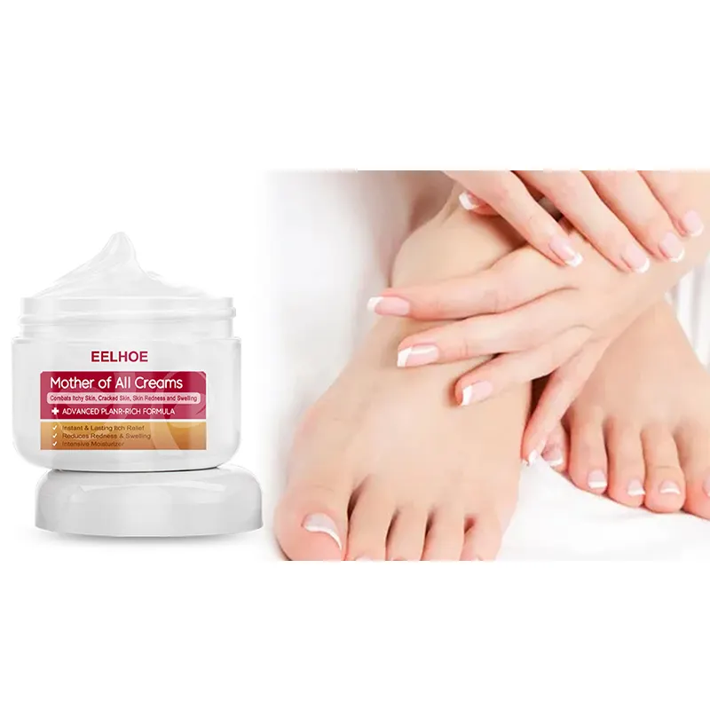 Wholesale Relieving Itching Crack Redness Swelling Mother of All Cream Organic Best Hand and Foot Whitening Repair Cream