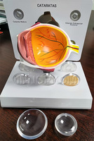 Modelo de Ojo Anatómico Premium de PVC, 3 Partes, 3D, con Cataratas, para Enseñanza, Diseño Desmontable de 3 Partes