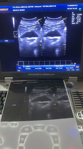 SUN-800F - Ecógrafo Portátil 3D de 15 Pulgadas con Batería Integrada, Sistema de Ultrasonido Digital para Obstetricia/Ginecología y <span class=keywords><strong>Vascular</strong></span>, para Uso en Hospitales Veterinarios - Product Image 6